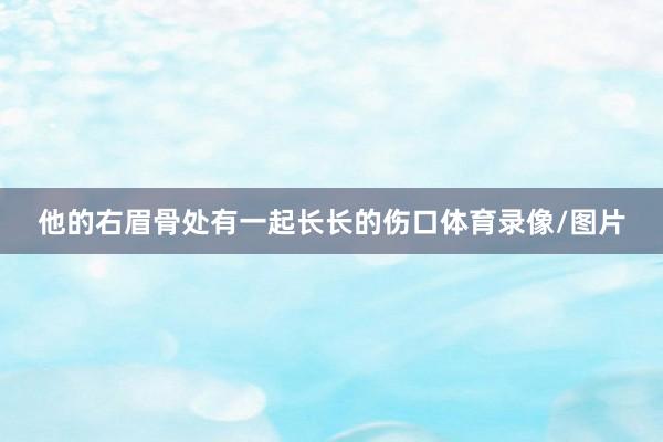 他的右眉骨处有一起长长的伤口体育录像/图片